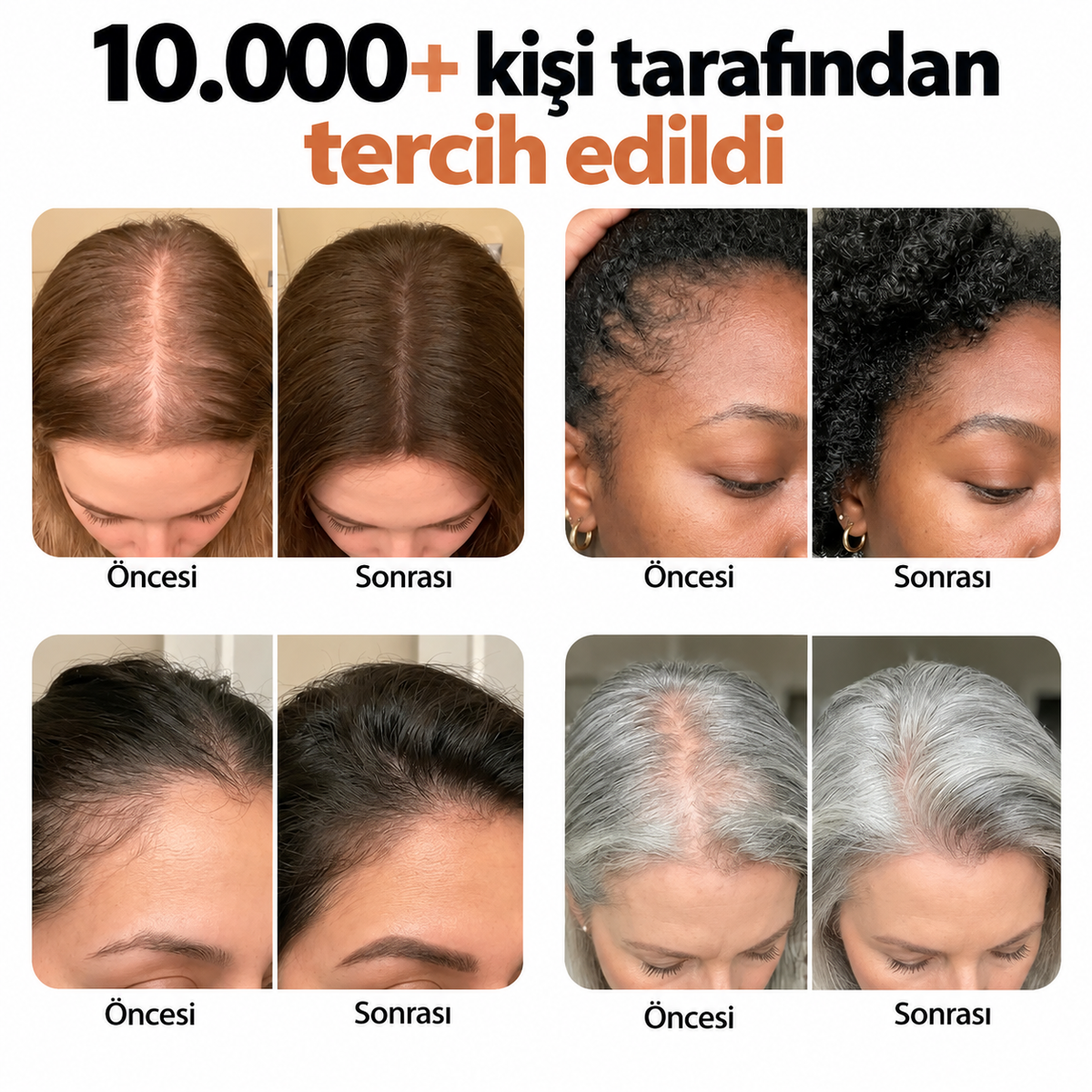 Noura Saç Bakım Serumu