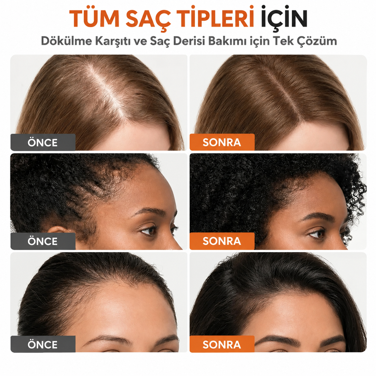 Noura Saç Bakım Serumu